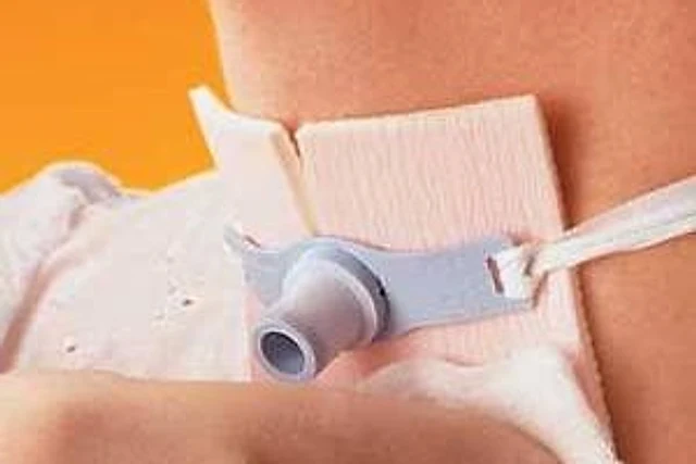 Close-up of a tracheostomy tube secured with a dressing
